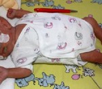 most smallest baby